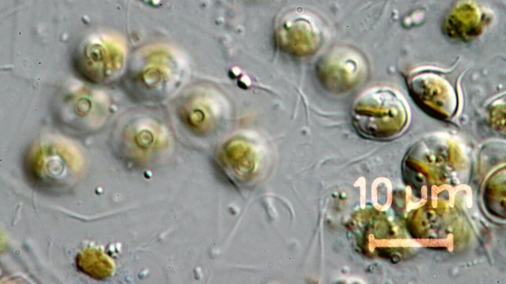 Lagynion delicatulum (Chrysophyceae)